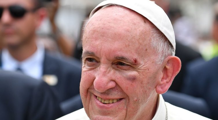 Popiežius Pranciškus vežamas papamobiliu patyrė traumą (nuotr. SCANPIX)