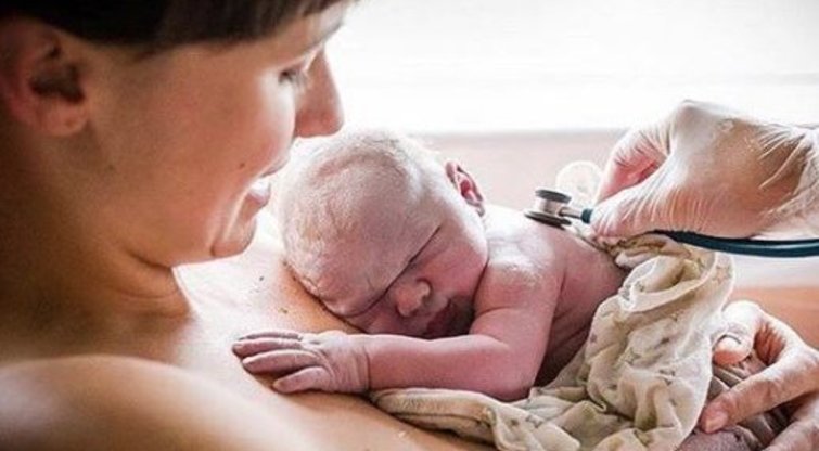 Drąsus atvirumas: po gimdymo – skausmingi kadrai  (nuotr. Instagram)