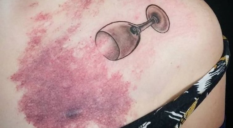 Tatuiruotes paslepiančios randus (nuotr. Instagram)