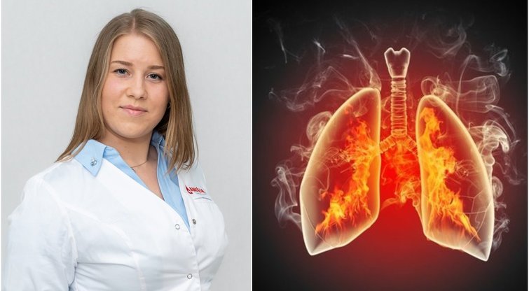 Šios plaučių ligos gali baigtis net mirtimi: ragina įsidėmėti simptomus (123rf.com, pranešimo spaudai nuotr.)  