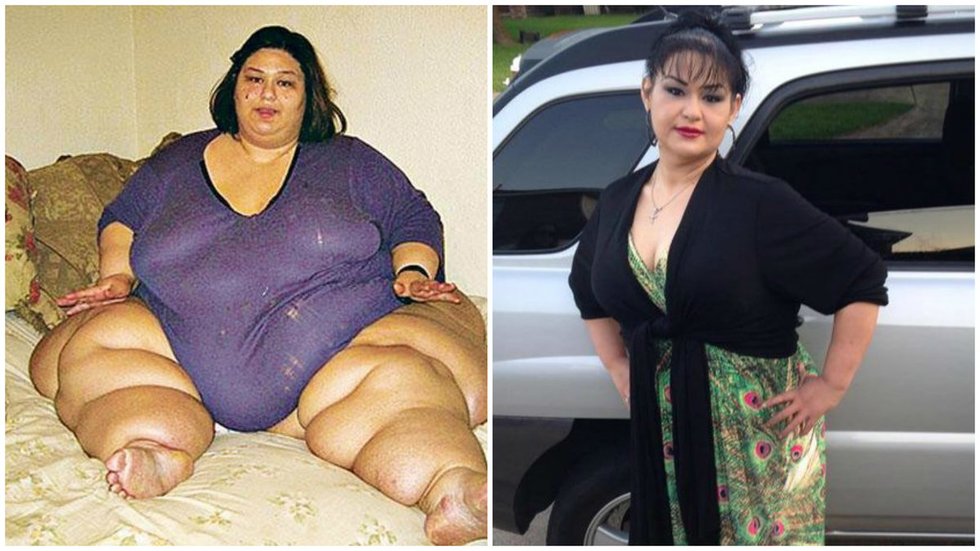 Šokiruojantys storiausios pasaulyje moters pokyčiai: atsikratė 400 kg. (nuotr. asmeninio albumo („Facebook“)