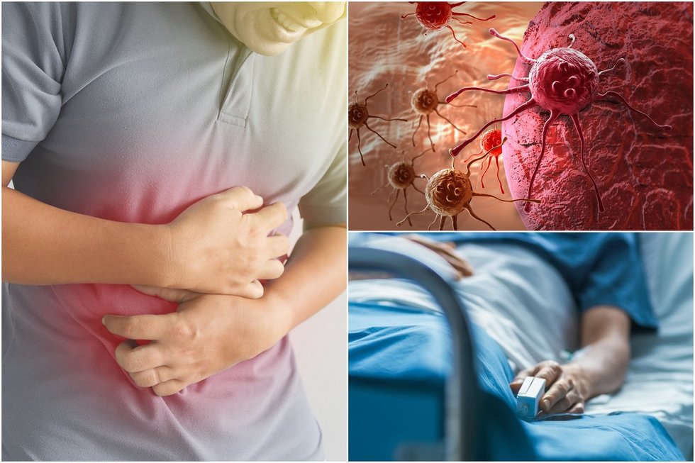 Klastinga liga prasideda be simptomų: dažniausiai renkasi vyrus (nuotr. Shutterstock.com)