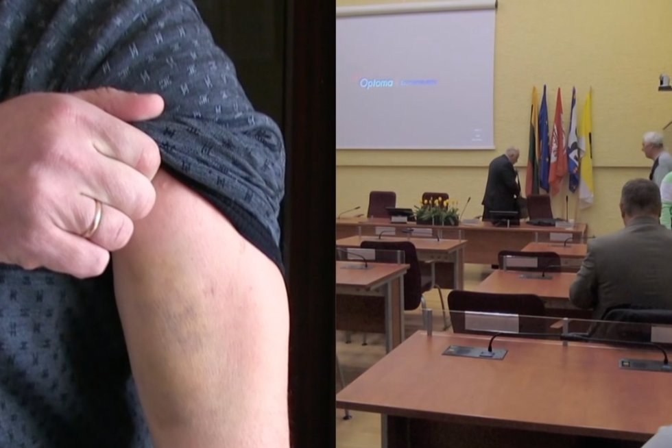 Radviliškio savivaldybėje sumuštas žurnalistas: medikai nustatė rankos sumušimą, sutrenktas smegenis (tv3.lt koliažas)